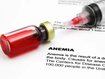 A anemia causa vários problemas no dia a dia de qualquer pessoa, saiba o que pode amenizar o impacto dessa doença.