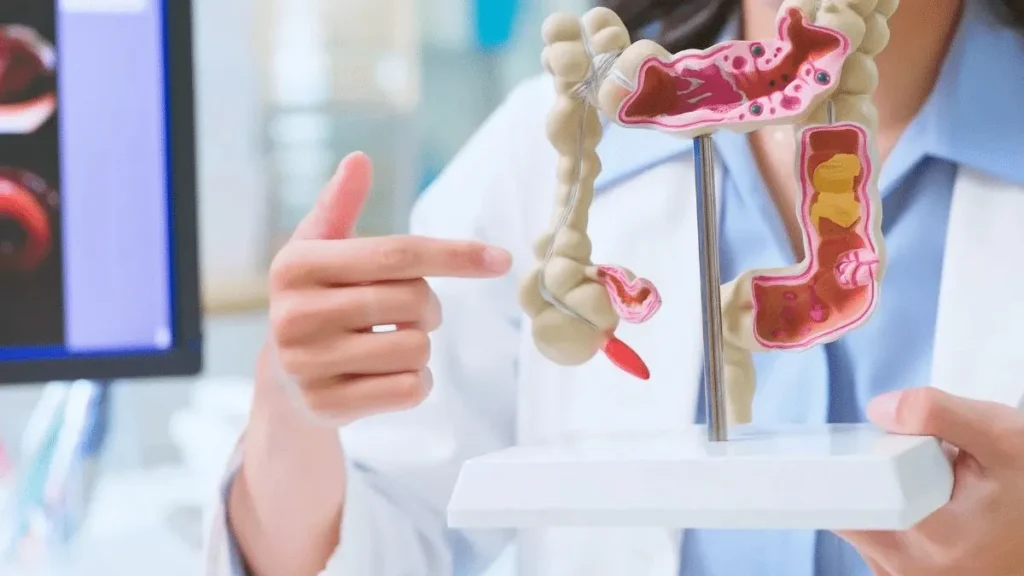 Recupere a flora intestinal em 30 dias com hábitos simples Recupere a flora intestinal em 30 dias com hábitos simples